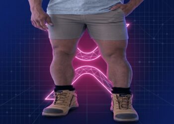 XRP News: Thinking of Shorting XRP? You Might Get Squeezed